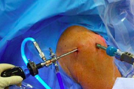 arthroscopy-3-1
